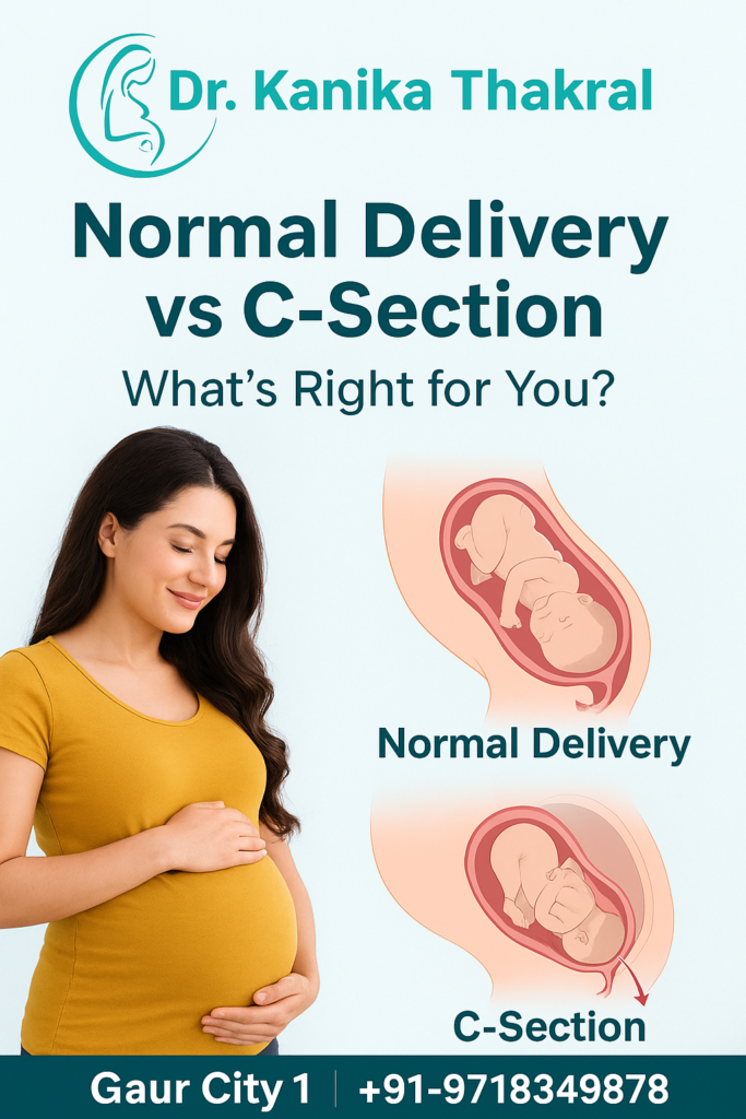 Normal Delivery vs C-Section: What’s Right for You?