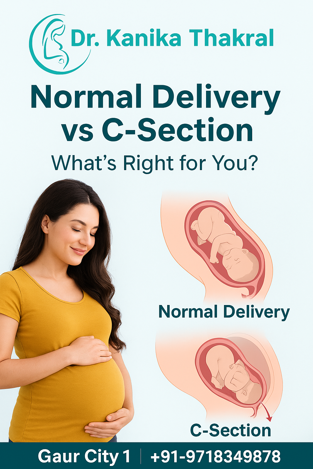 Normal Delivery vs C-Section: What’s Right for You?