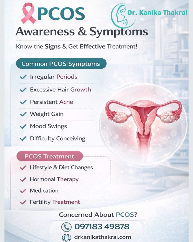 PCOS symptoms treatment