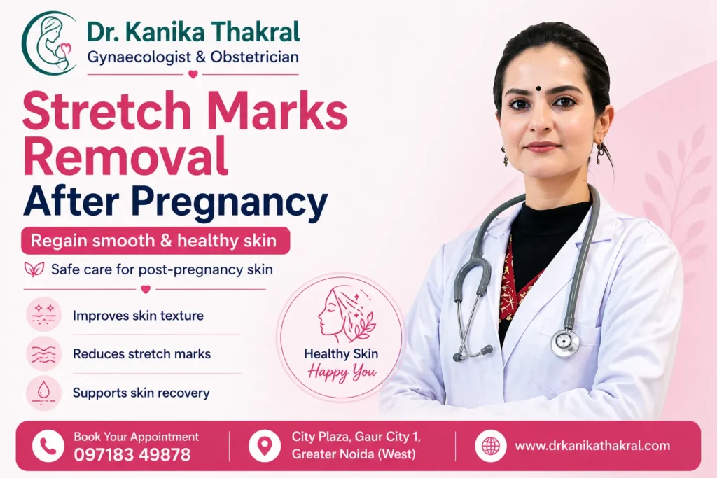 Stretch Marks Removal After Pregnancy in Gaur City