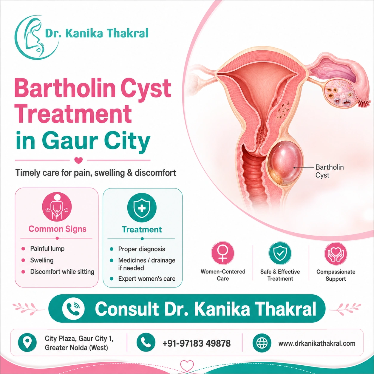 Bartholin Cyst Treatment