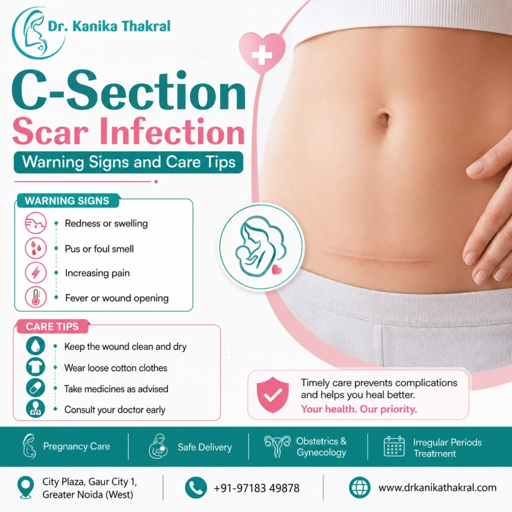 C-Section Scar Infection