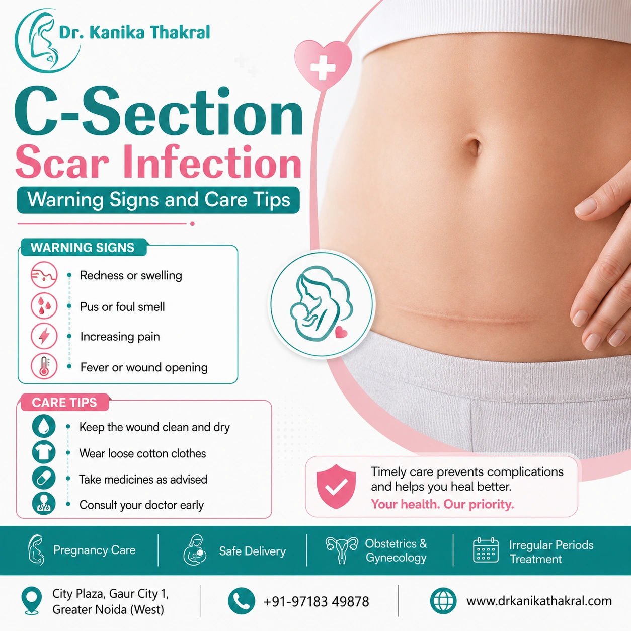 C-Section Scar Infection
