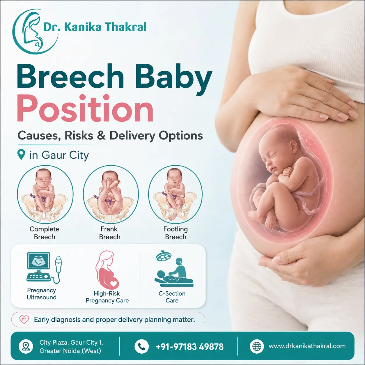Breech Baby Position: Causes, Risks and Delivery Options in Gaur City