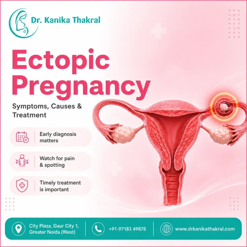 Ectopic Pregnancy