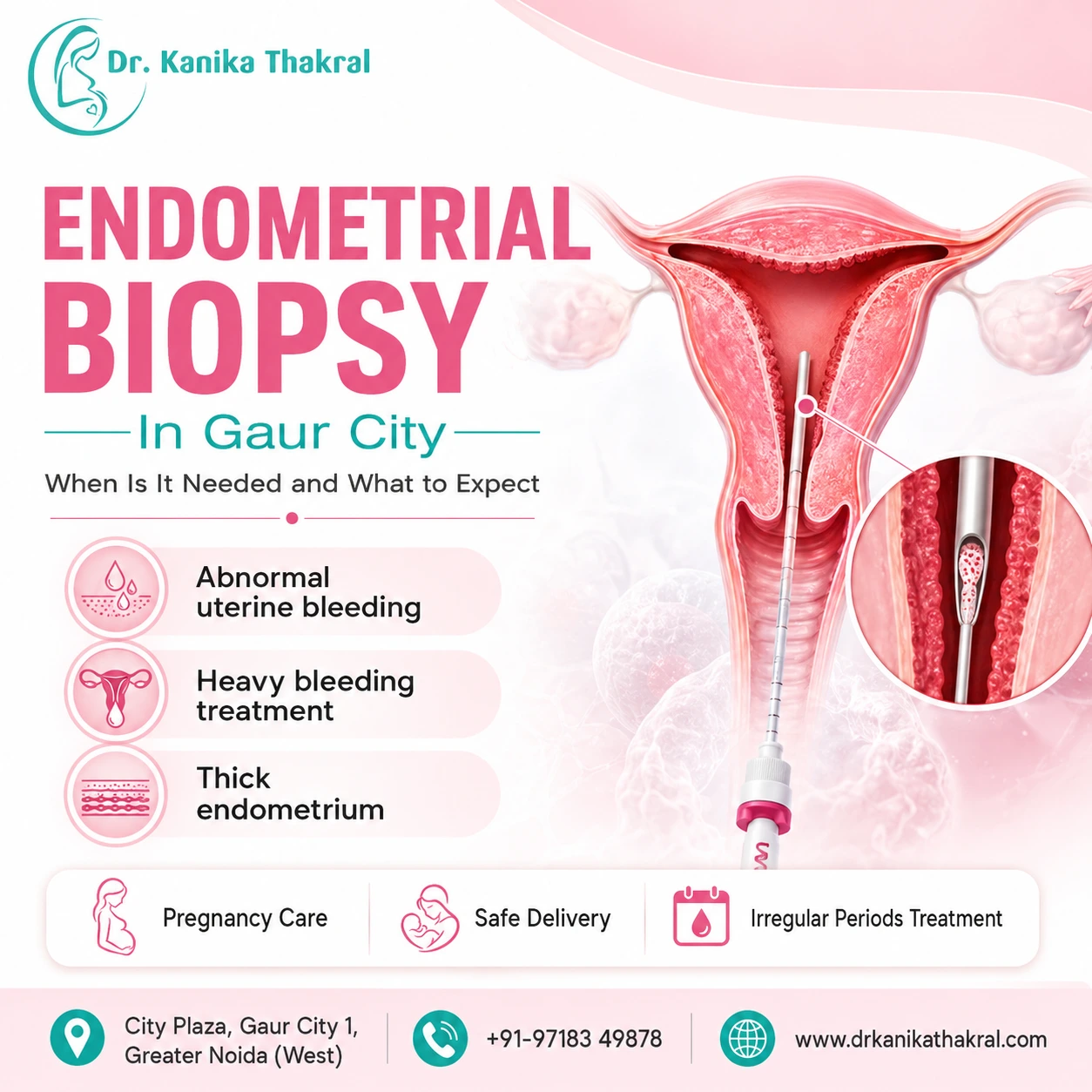 Endometrial Biopsy