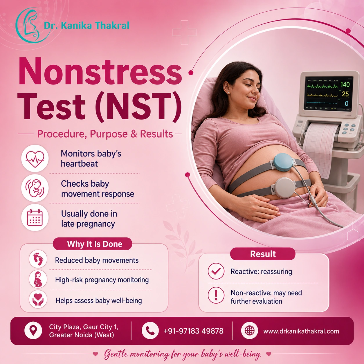 Nonstress Test