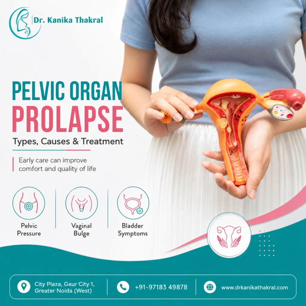 Pelvic Organ Prolapse