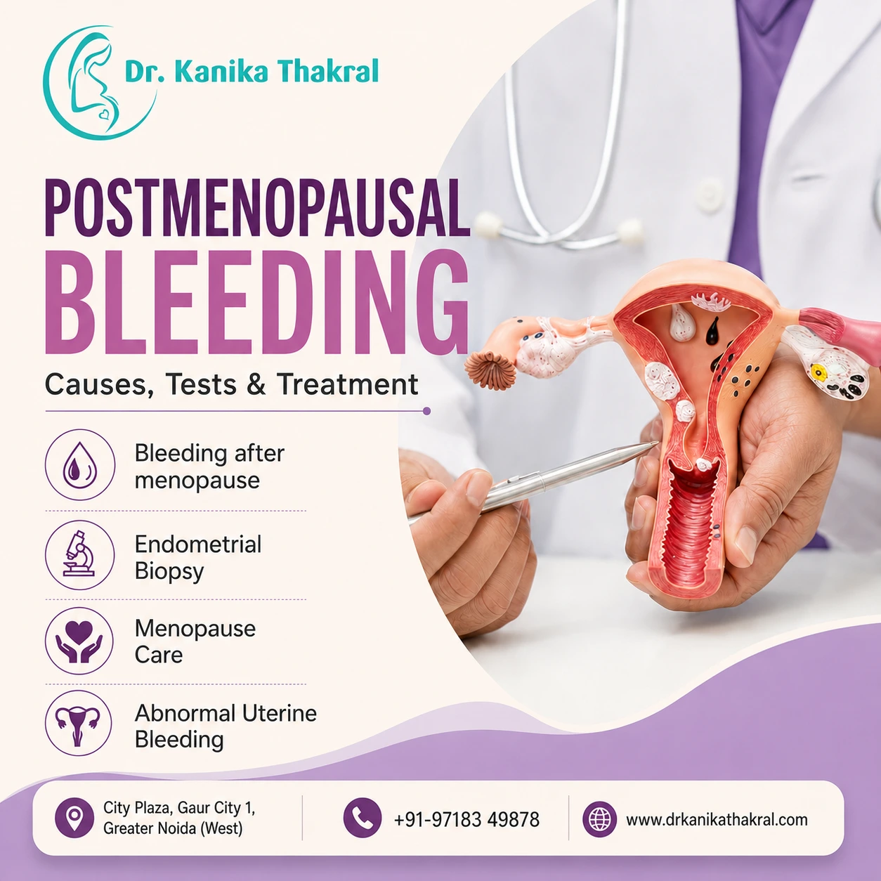 Postmenopausal Bleeding