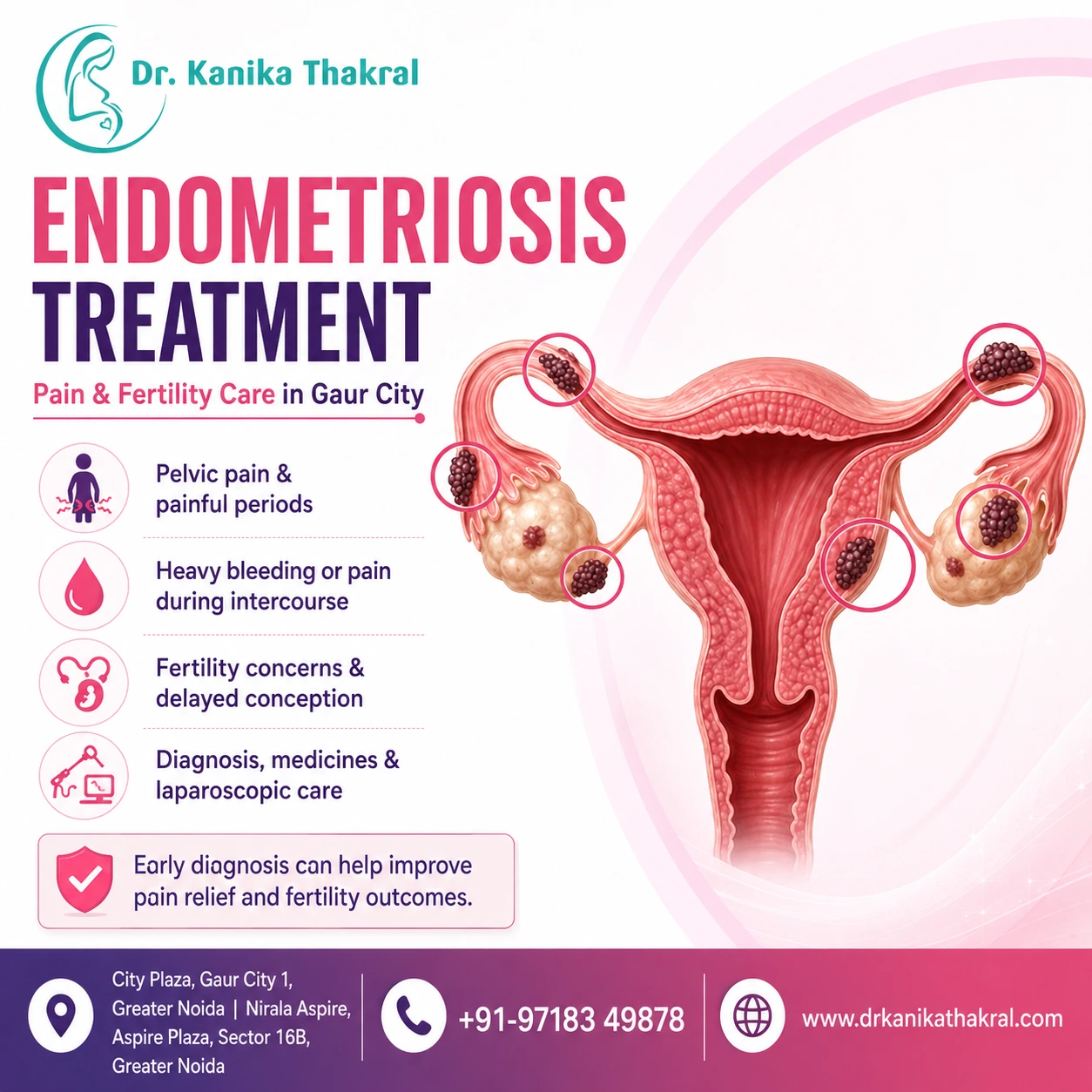 Endometriosis Treatment
