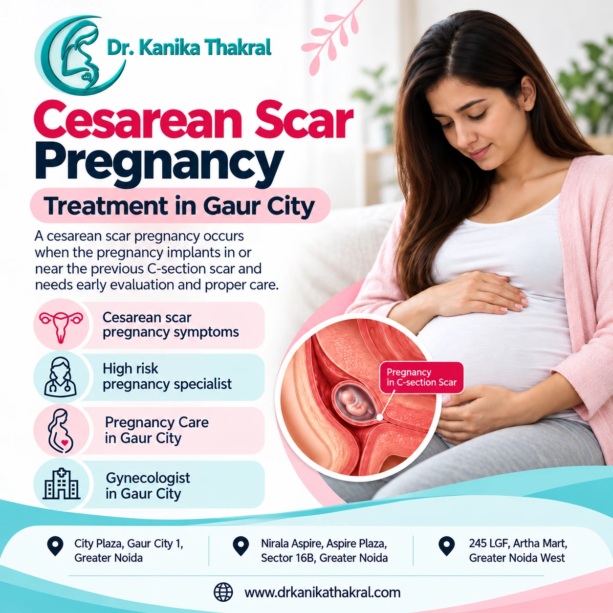 Cesarean Scar Pregnancy Treatment