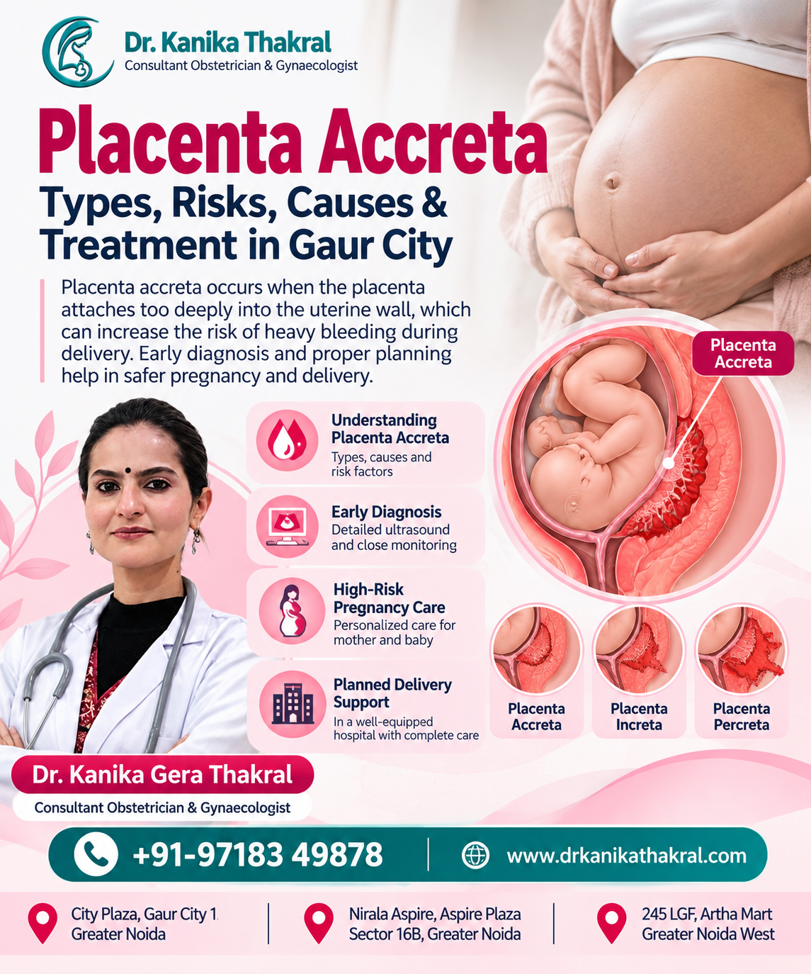 Placenta Accreta Treatment in Gaur City by Dr. Kanika Gera Thakral for high-risk pregnancy care and planned delivery